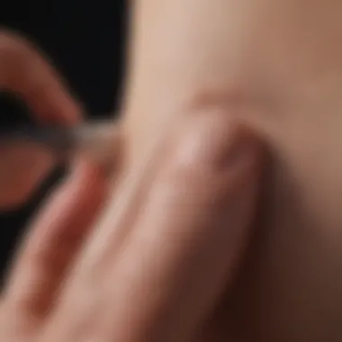 Application of Wart Treatment Cream Showing a hand applying cream for wart treatment