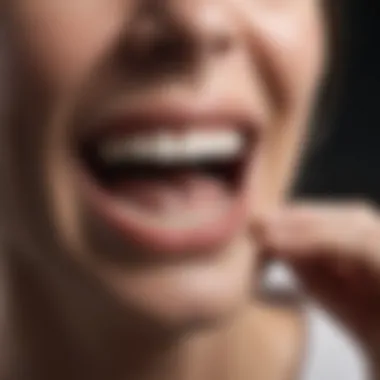 Effects of Bruxism on Teeth Illustration of teeth grinding