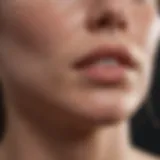 Close-up view of cystic acne on the chin
