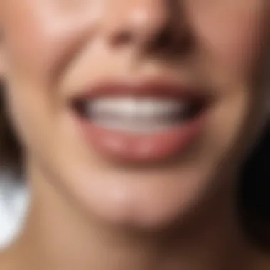 Whitening strips applied to teeth